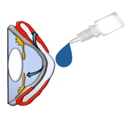 Current Treatments Illustration