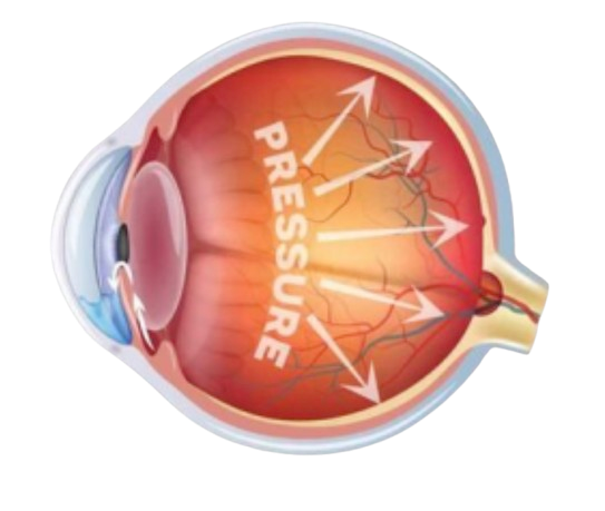 Problem Framing Illustration